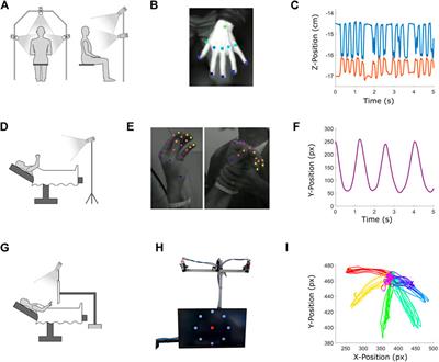 Deep learning based markerless motion tracking as a clinical tool for movement disorders: Utility, feasibility and early experience